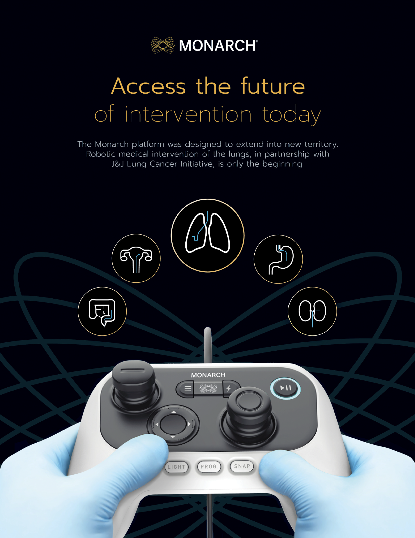 Monarch print ad — Access the future of intervention today